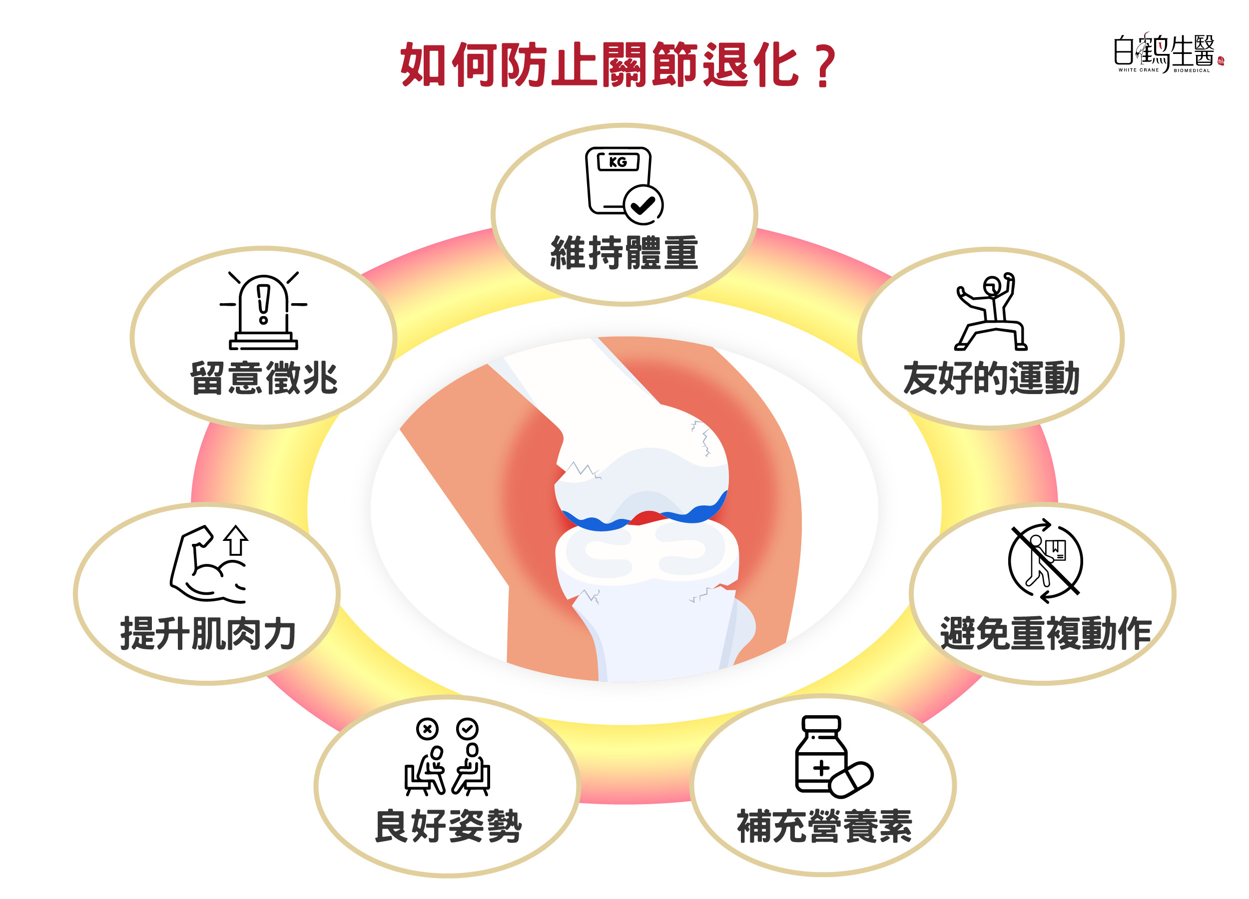 維持健康體重、定期運動、避免長時間重複動作、補充關節保健營養素、保持良好姿勢皆有助於防止關節退化