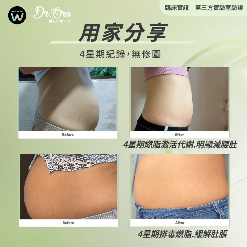 單盒 / 組合 - Lactolean  - 燃脂纖型益生菌康普茶