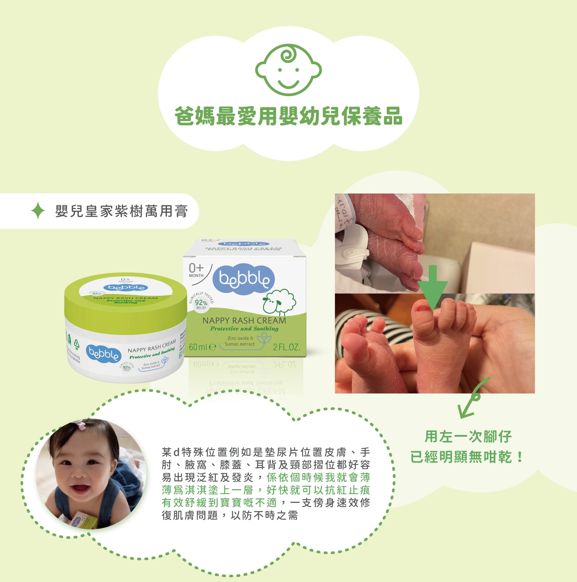 BEBBLE 嬰兒用品用家分享