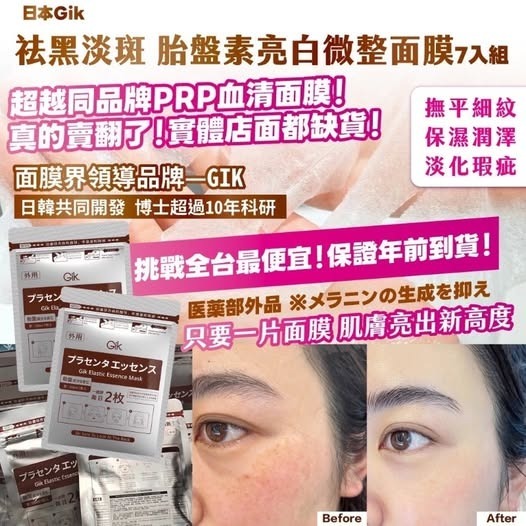 日本Gik祛黑淡斑胎盤素亮白微整面膜 (1包7片) R298
