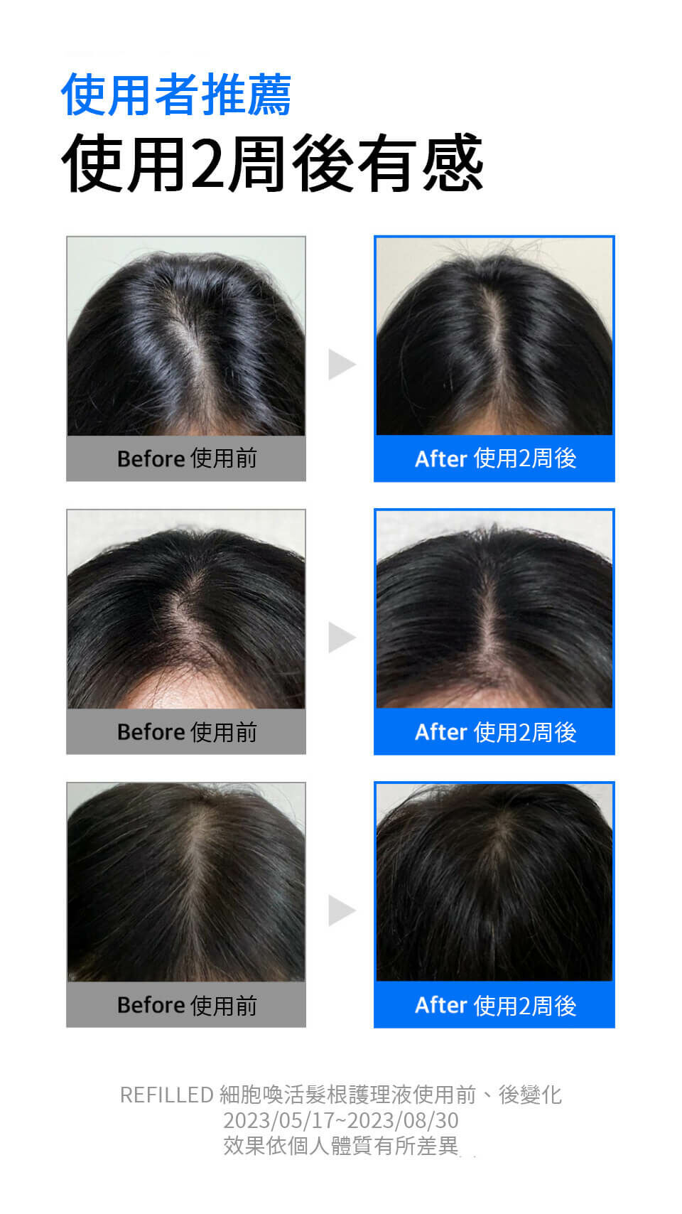 REFILLED 細胞喚活髮根護理液