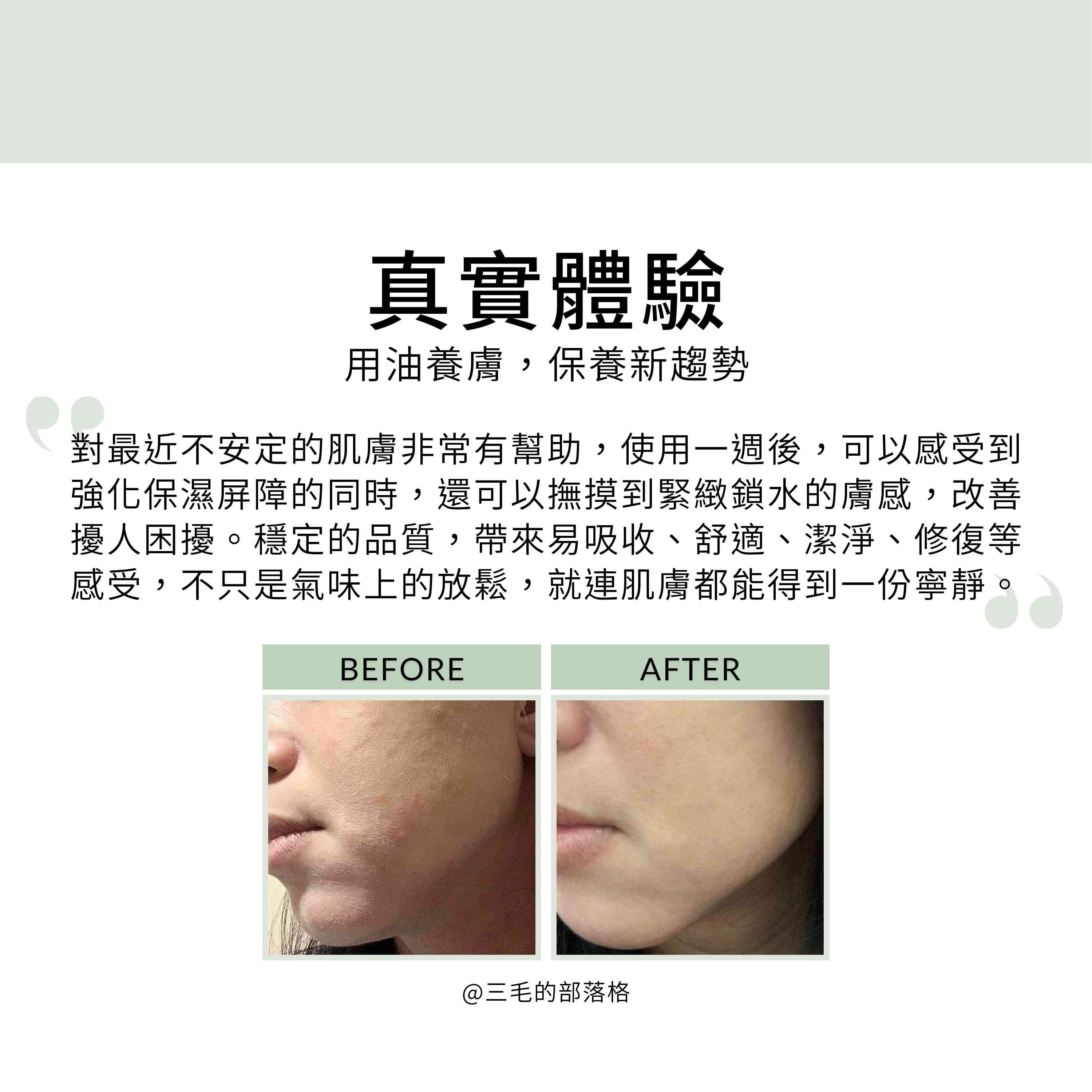 乳香緊緻油的真實體驗回饋