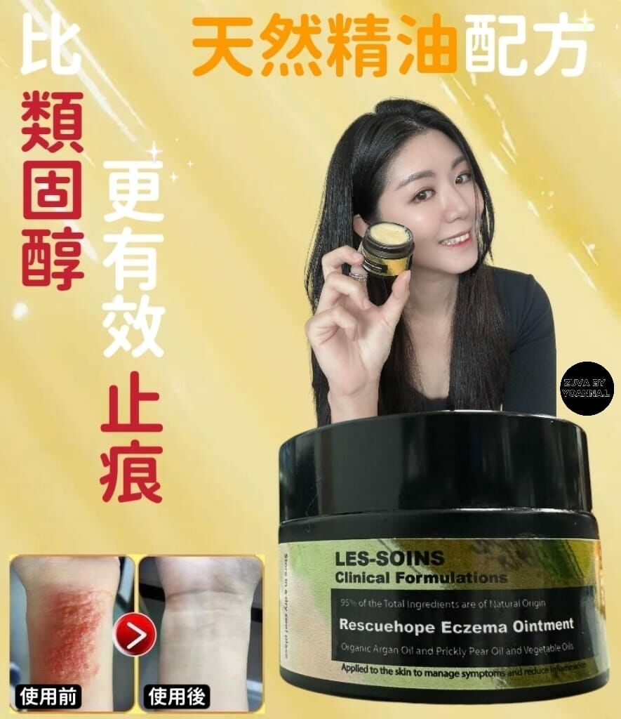 R284有機天然品牌Les-soins 精油提煉製造的濕疹軟膏50ml ( 主婦手、痤瘡、牛皮癬、濕疹、暗瘡、任何皮膚敏感均適用）