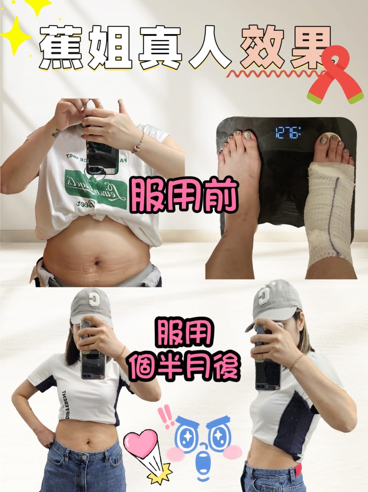 台灣 茵若纖系列 (K1 JT281)