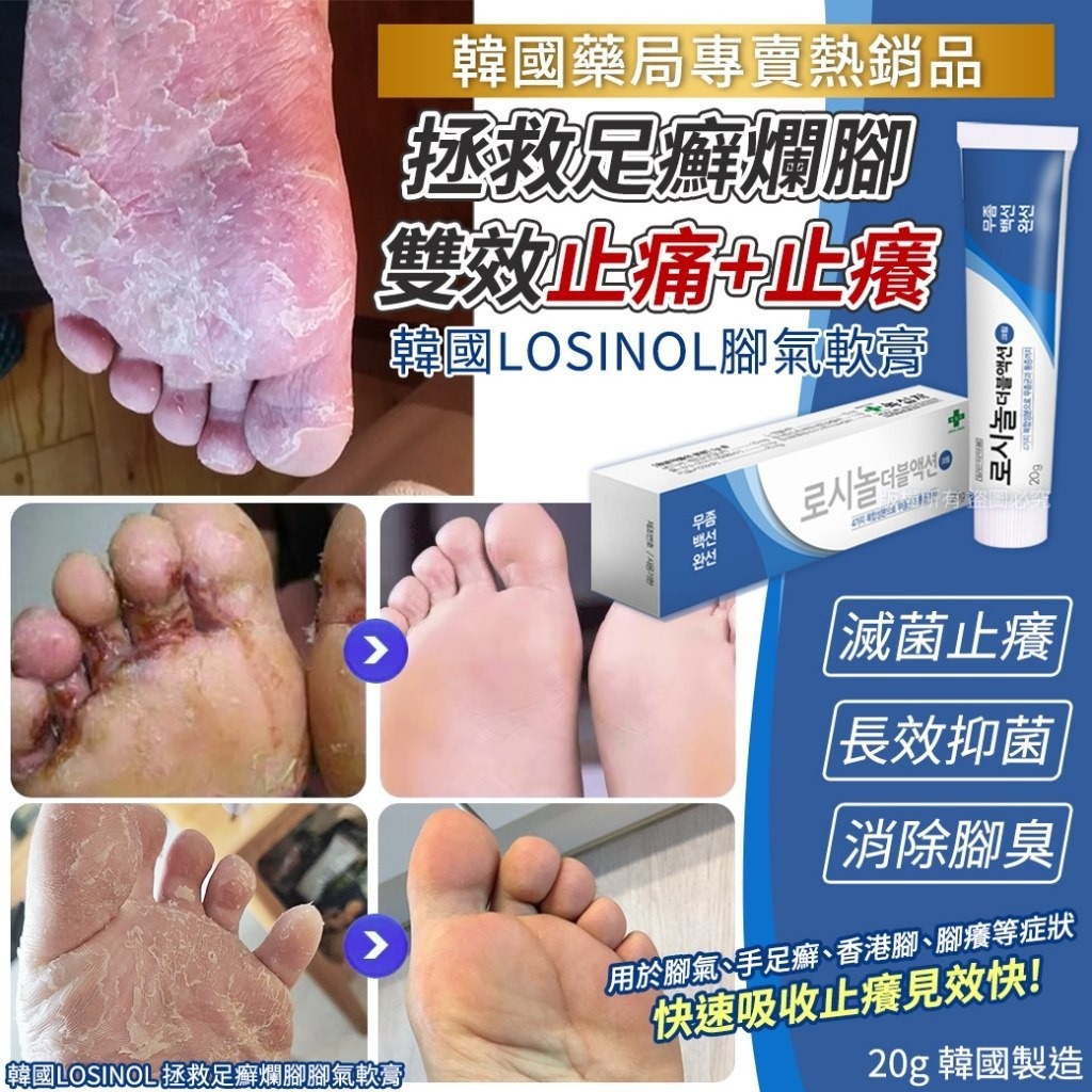 韓國LOSINOL腳氣軟膏