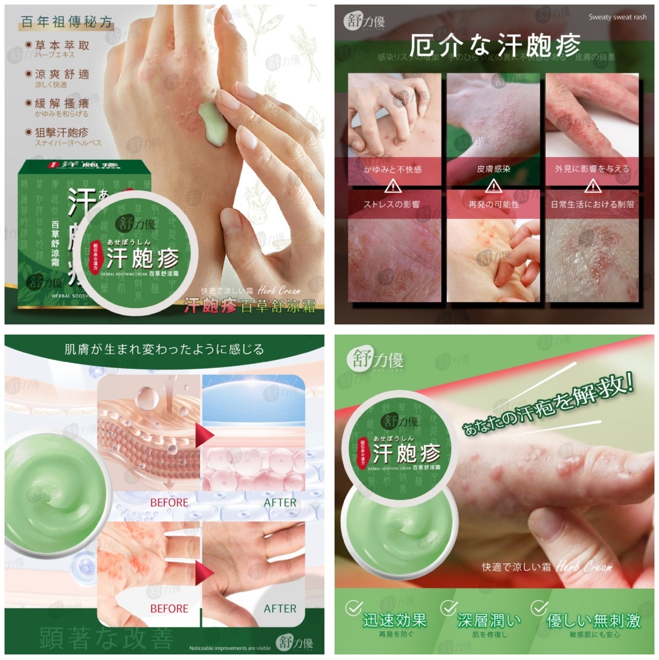 舒力優汗泡疹百草舒凉霜30g