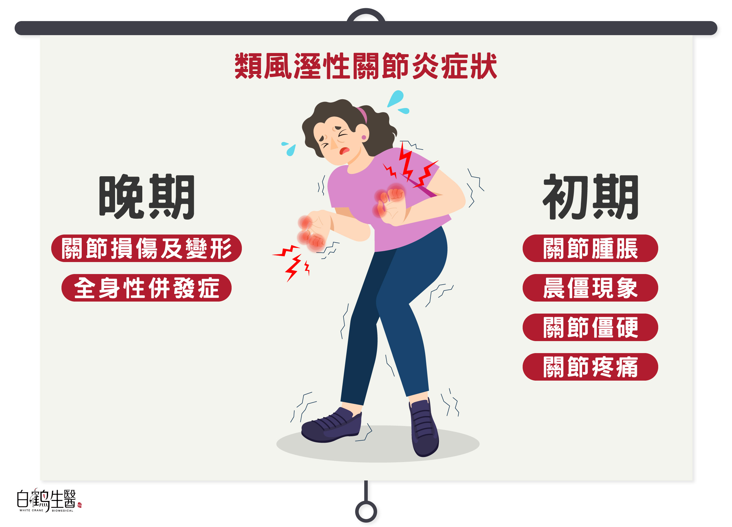類風溼性關節炎初期症狀包含關節腫脹、疼痛以及晨僵現象，晚期症狀包含關節損傷以及全身性併發症。
