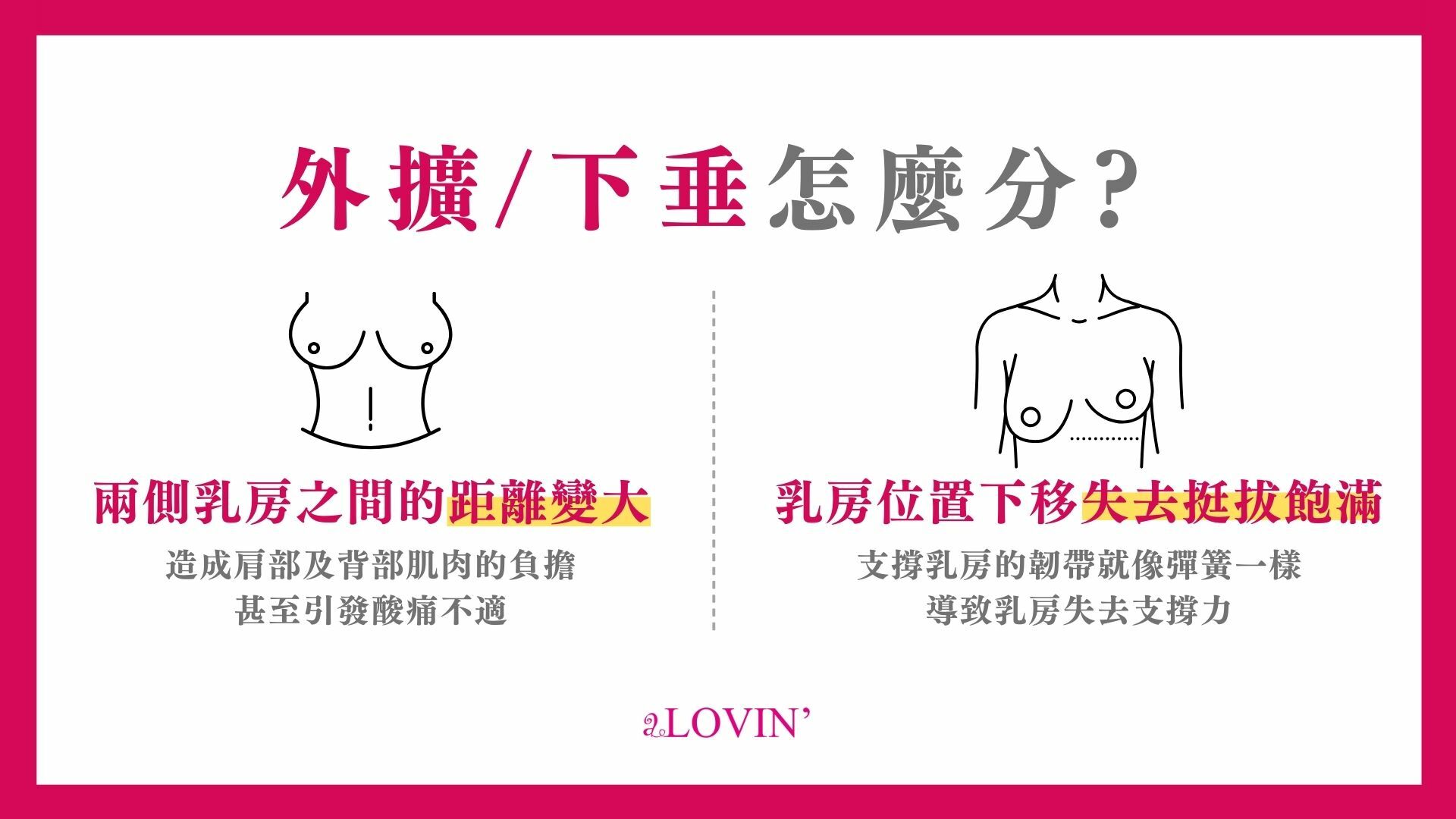 胸部下垂、外擴怎麼分？