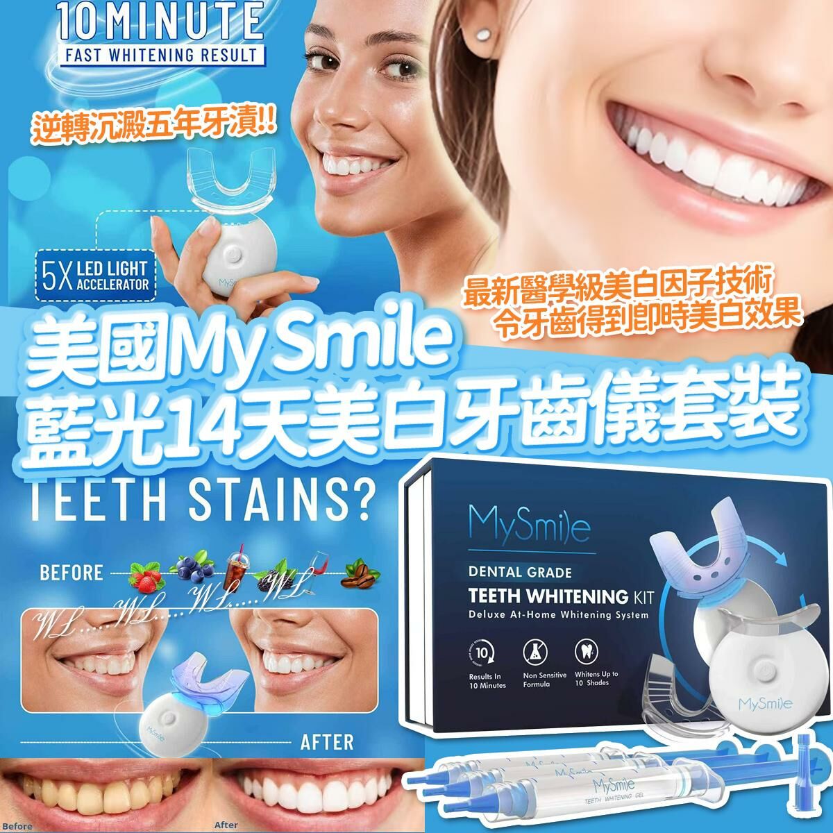 美國 My Smile 藍光14天美白牙齒儀套裝