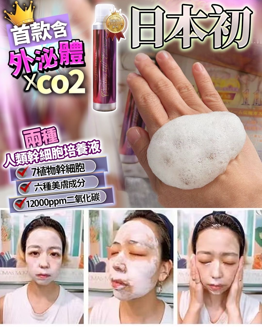 🥰日本外泌體co2