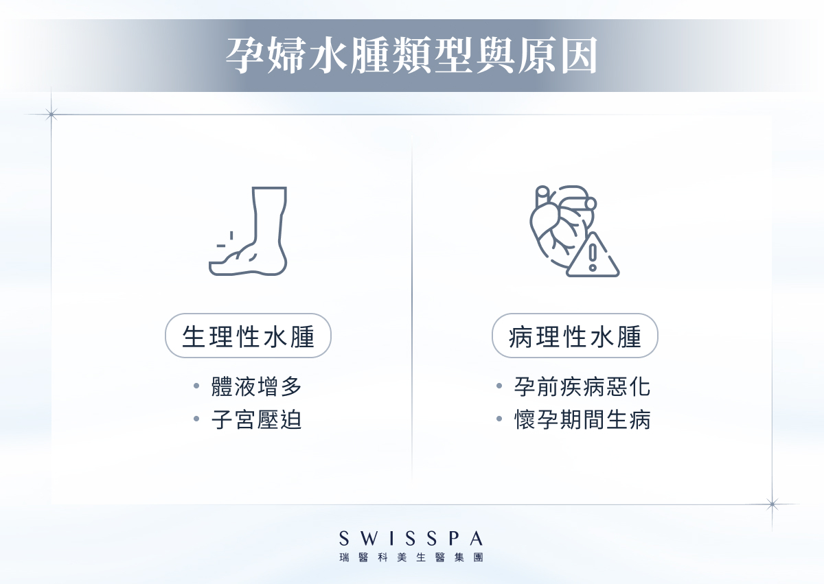 孕婦水腫類型與原因