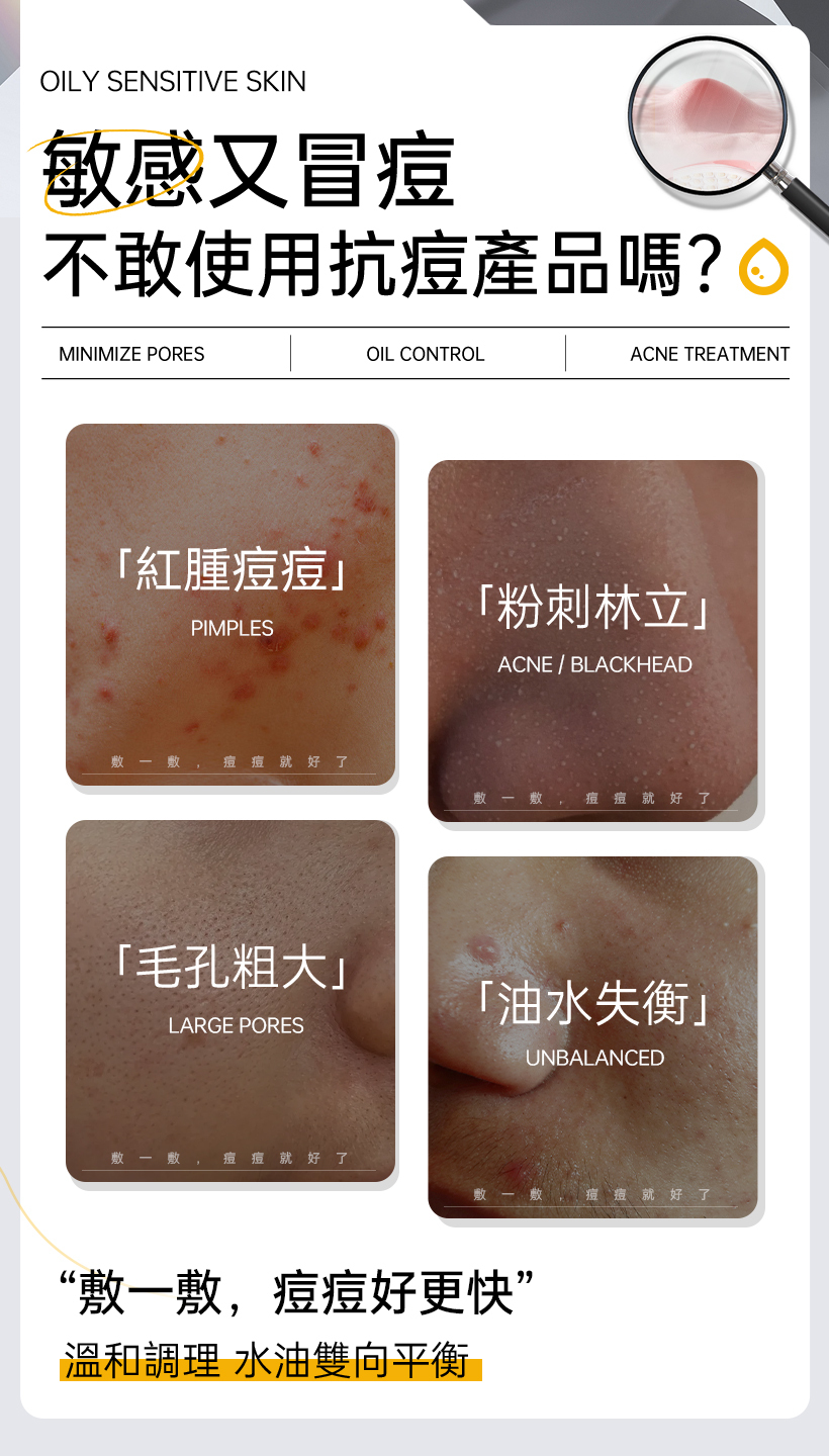 抗痘化妝水_粉刺化妝水_收斂水