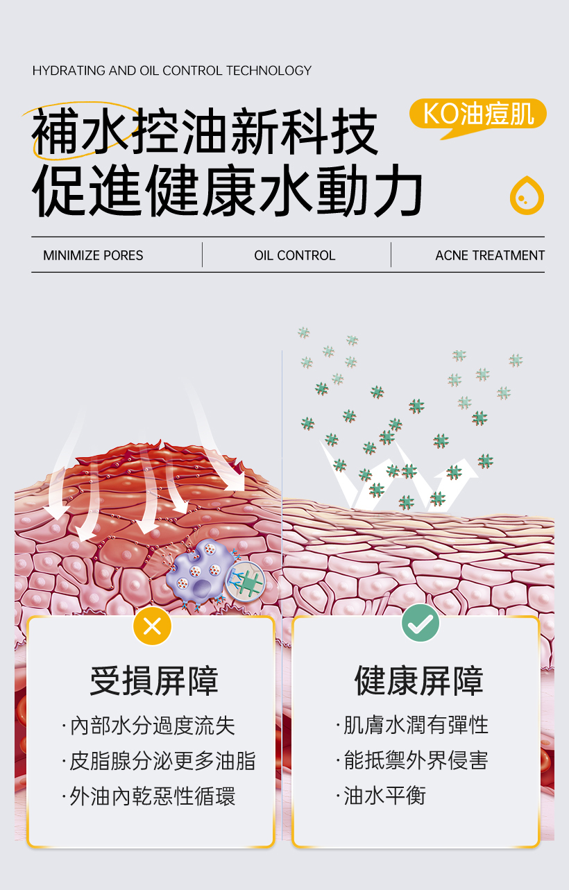 抗痘化妝水_粉刺化妝水_收斂水
