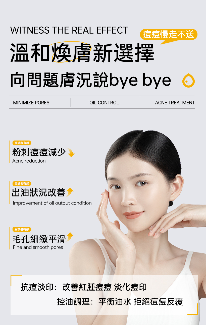 抗痘化妝水_粉刺化妝水_收斂水