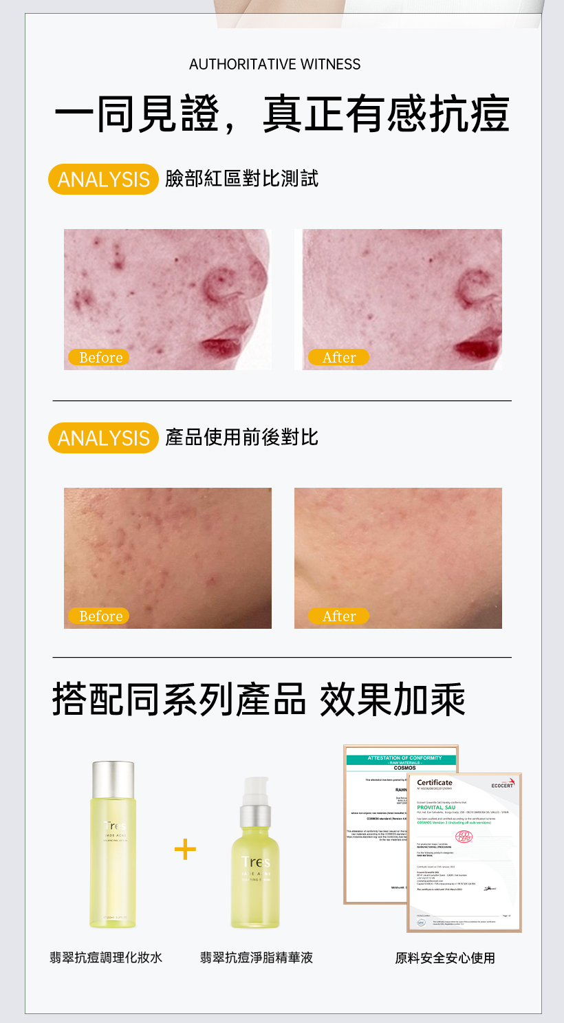 抗痘化妝水_粉刺化妝水_收斂水