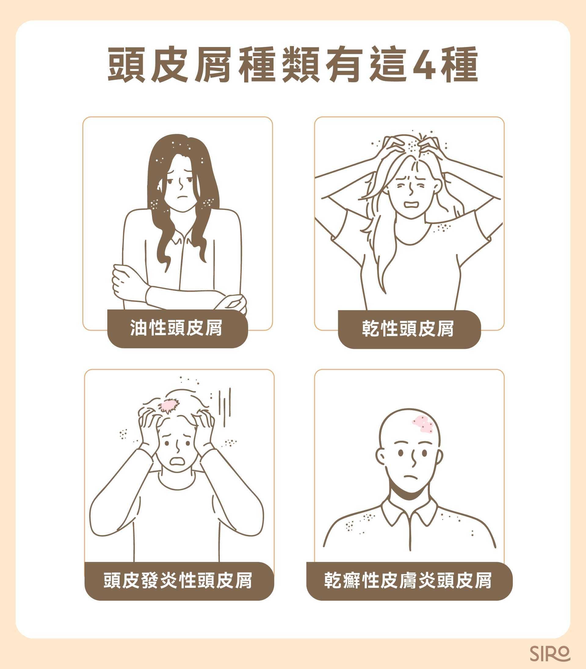 頭皮屑種類有這 4 種