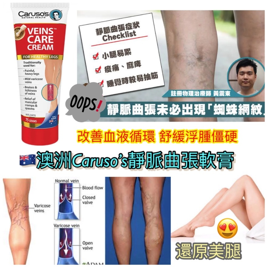 澳洲Caruso’s 靜脈曲張膏
