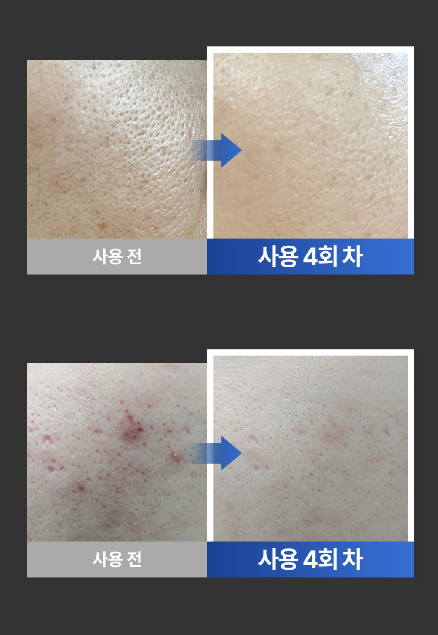 〖售完不補〗Dermathod |  家用MTS印章