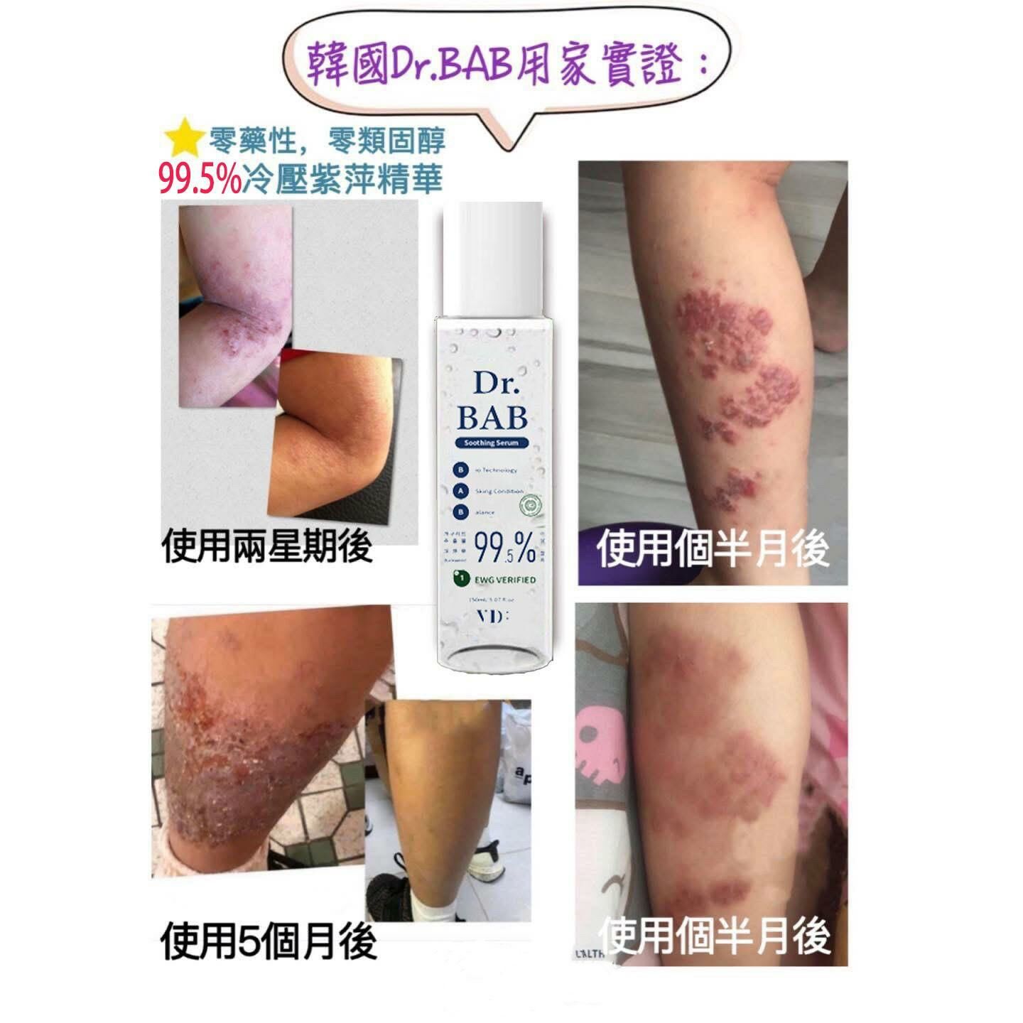 (609)【多件優惠; 多買多送】DR BAB Soothing Serum 升級+增量限量版
