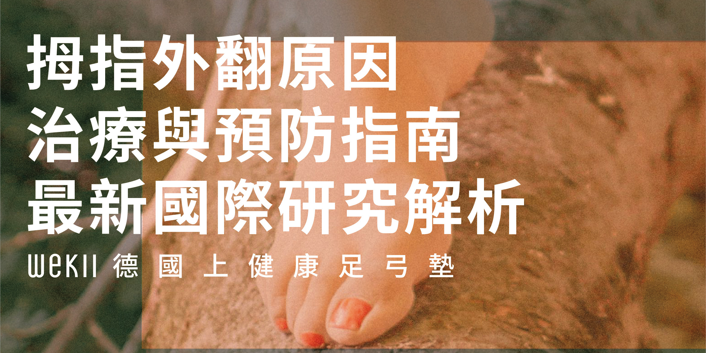 拇指外翻原因、治療與預防指南｜最新國際研究解析