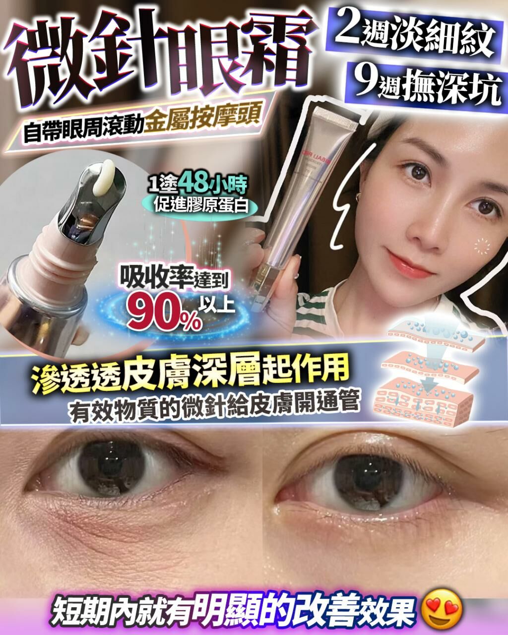 微針眼 R436（1-2星期寄出）