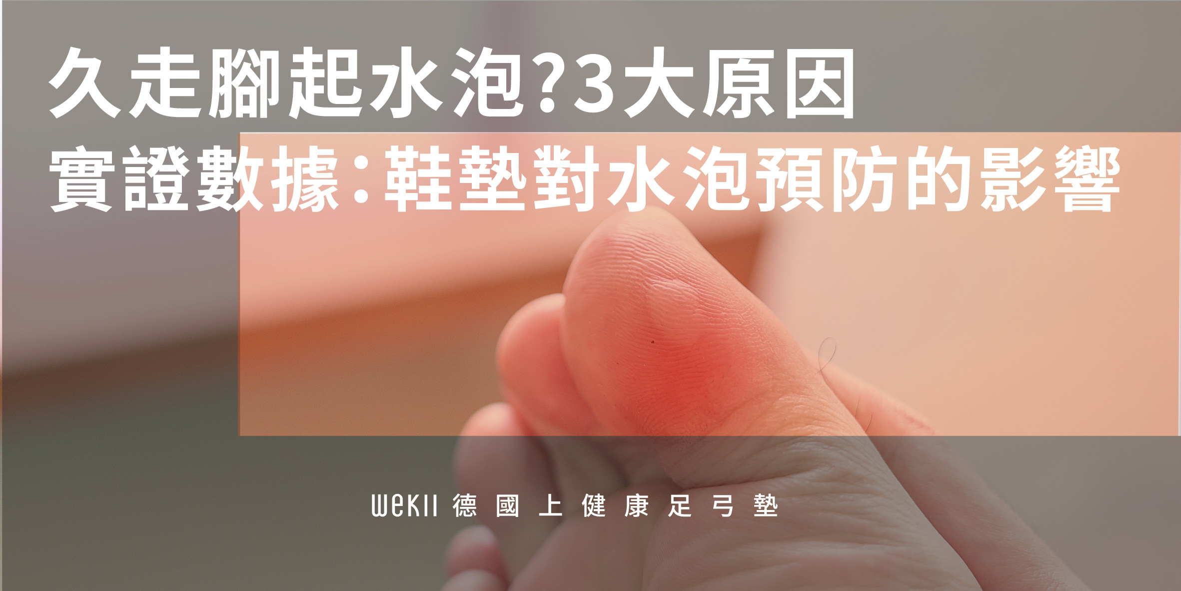 久走腳起水泡? 3大原因 實證數據：鞋墊對水泡預防的影響