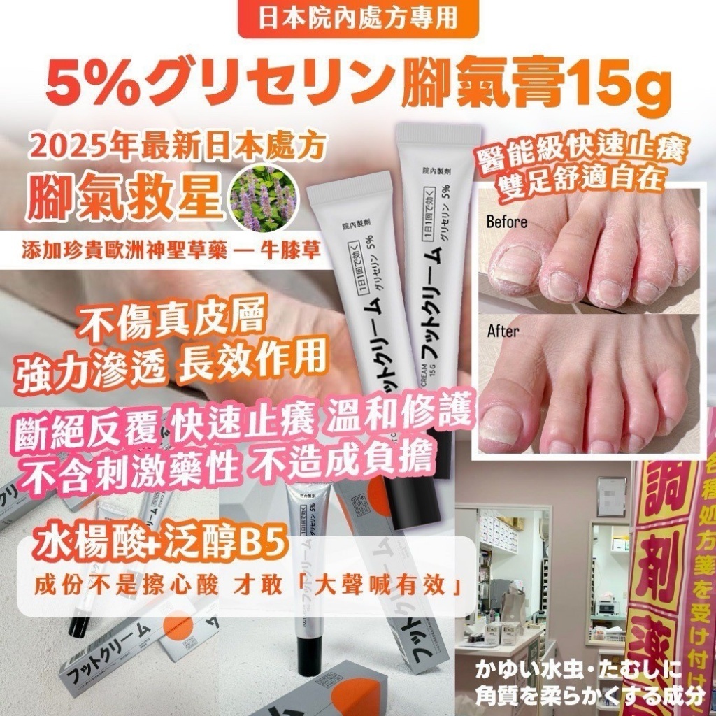 日本院內處方專用 ｜5%グリセリン腳氣膏