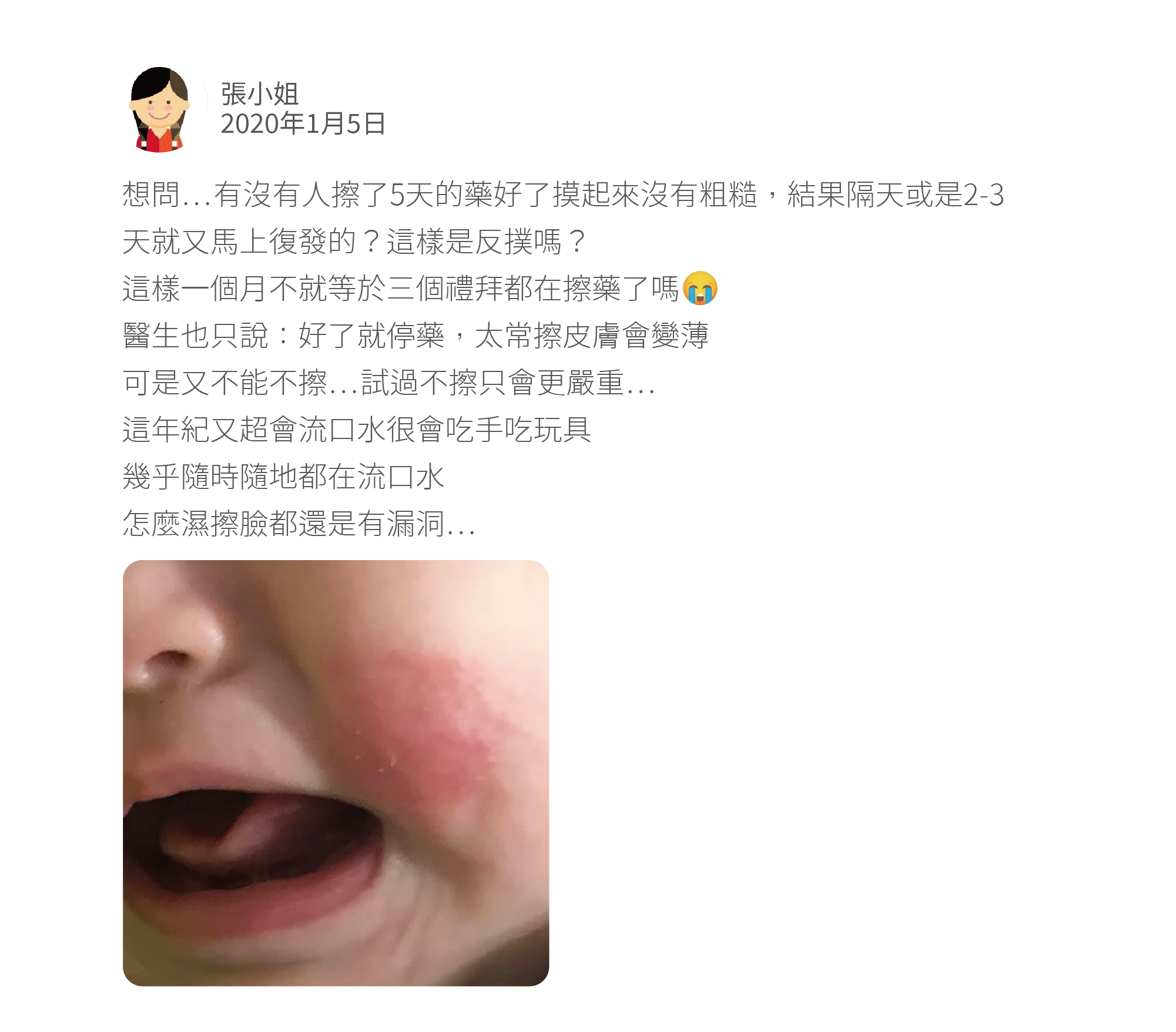 想問⋯有沒有人擦了5天的藥好了摸起來沒有粗糙，結果隔天或是2-3天就又馬上復發的？這樣是反撲嗎？ 這樣一個月不就等於三個禮拜都在擦藥了嗎 醫生也只說：好了就停藥，太常擦皮膚會變薄 可是又不能不擦⋯試過不擦只會更嚴重⋯ 這年紀又超會流口水很會吃手吃玩具 幾乎隨時隨地都在流口水 怎麼濕擦臉都還是有漏洞⋯