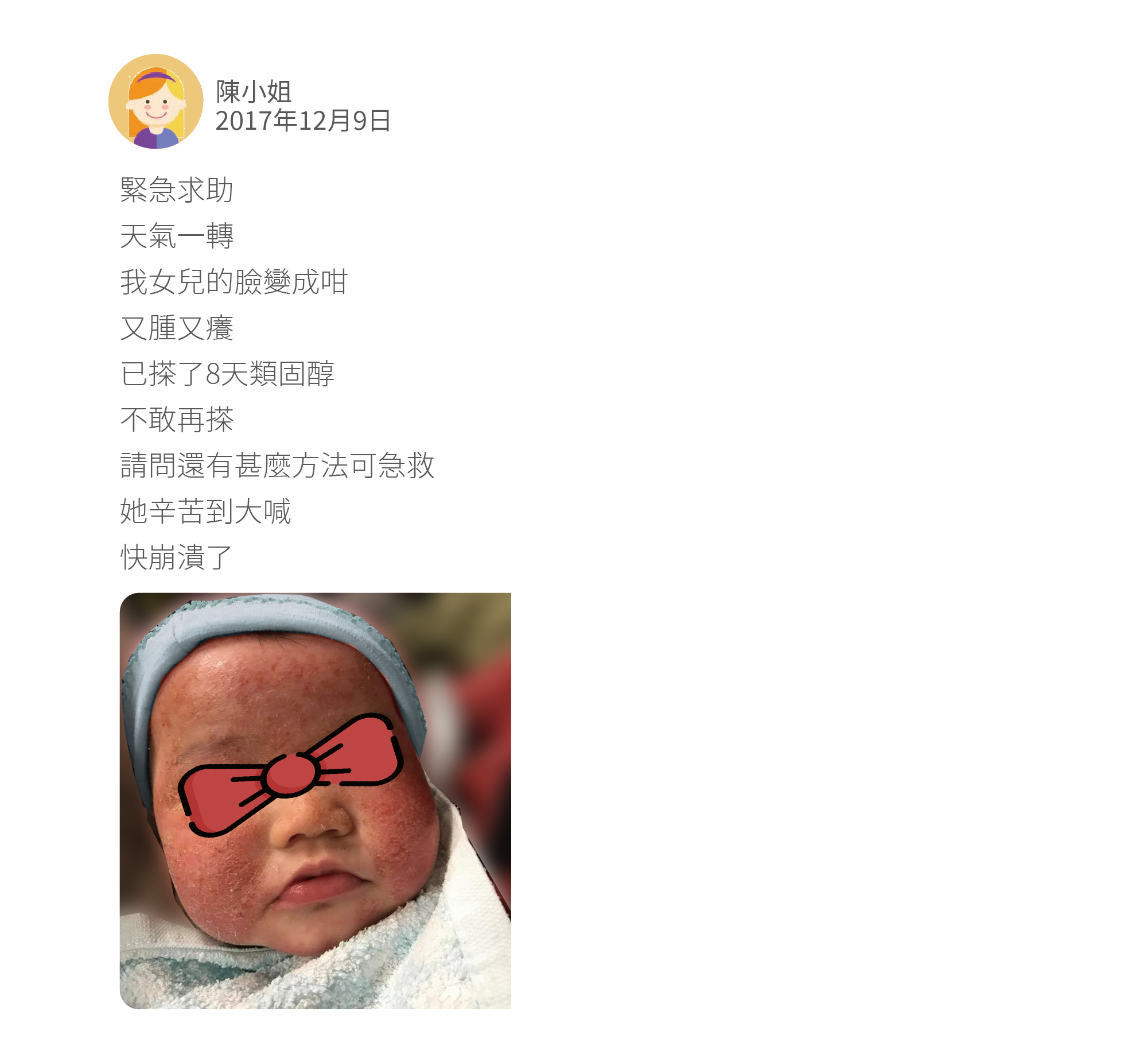 緊急求助 天氣一轉 我女兒的臉變成咁 又腫又癢 已搽了8天類固醇 不敢再搽 請問還有甚麼方法可急救 她辛苦到大喊 快崩潰了