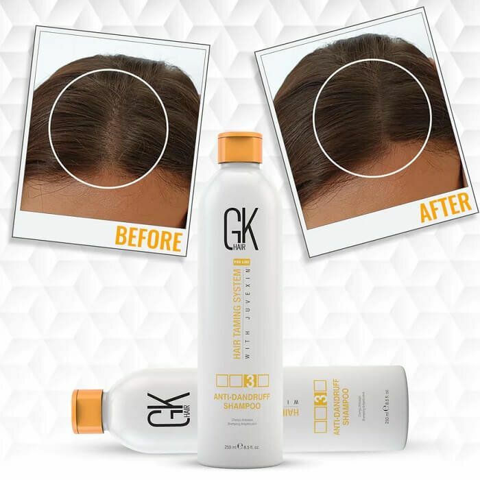 GK HAIR - Anti Dandruff Shampoo 250ml - Deep Cleansing, Impurities Remover Anti Residue (Sulfate Free Shampoo)