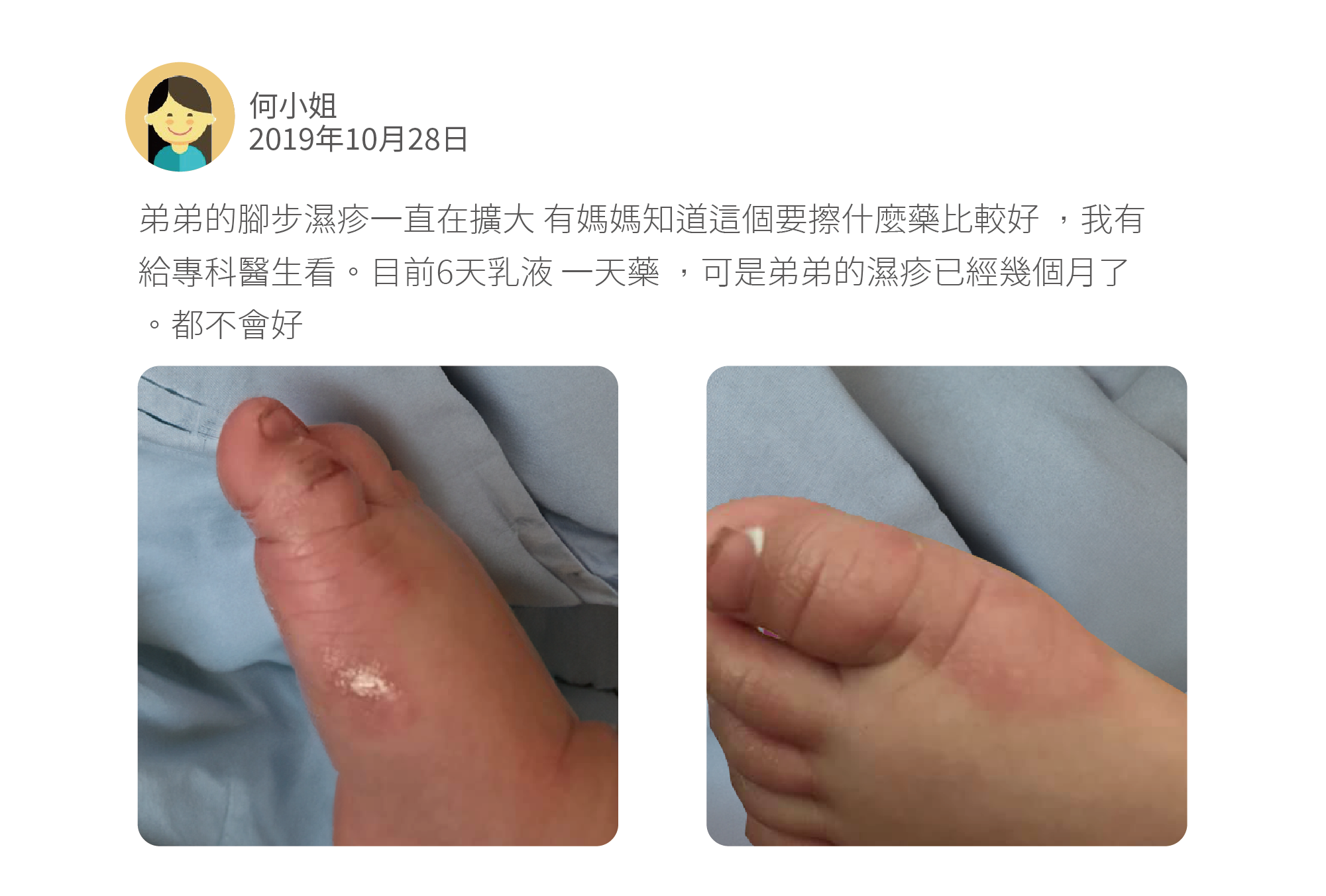 弟弟的腳步濕疹一直在擴大 有媽媽知道這個要擦什麼藥比較好 ，我有給專科醫生看。目前6天乳液 一天藥 ，可是弟弟的濕疹已經幾個月了。都不會好