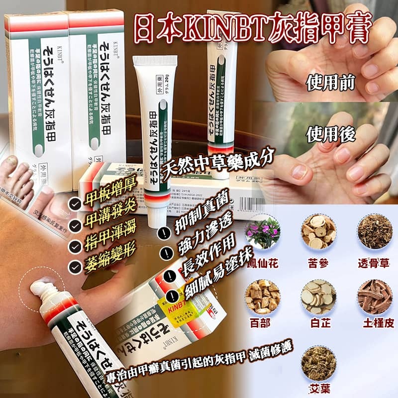 日本 KINBT 灰指甲膏 (1套2支)