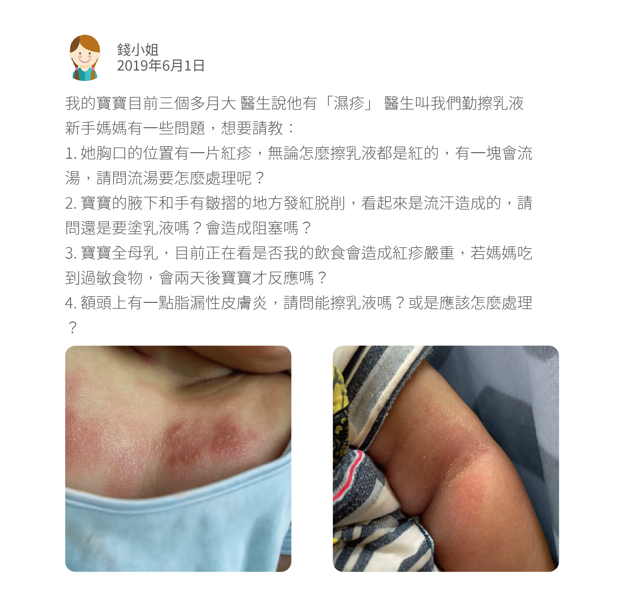 我的寶寶目前三個多月大 醫生說他有「濕疹」 醫生叫我們勤擦乳液 新手媽媽有一些問題，想要請教：