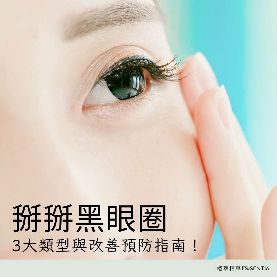 掰掰黑眼圈，3 大類型與改善預防指南！