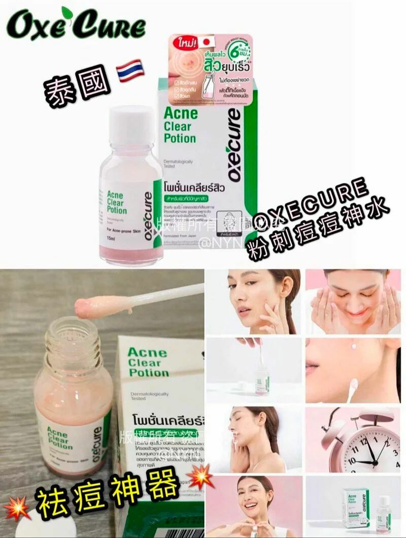 【預訂】AF2808 泰國 OXECURE Acne Clear Potion 粉刺痘痘神水 15ml