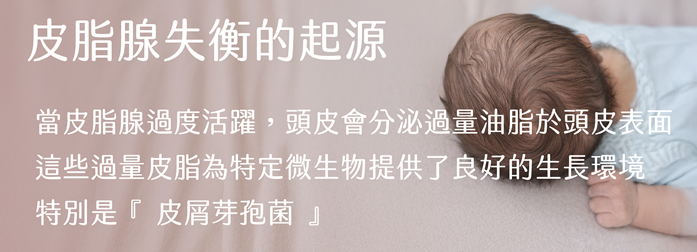 皮脂失衡,皮脂腺過多,皮脂旺盛