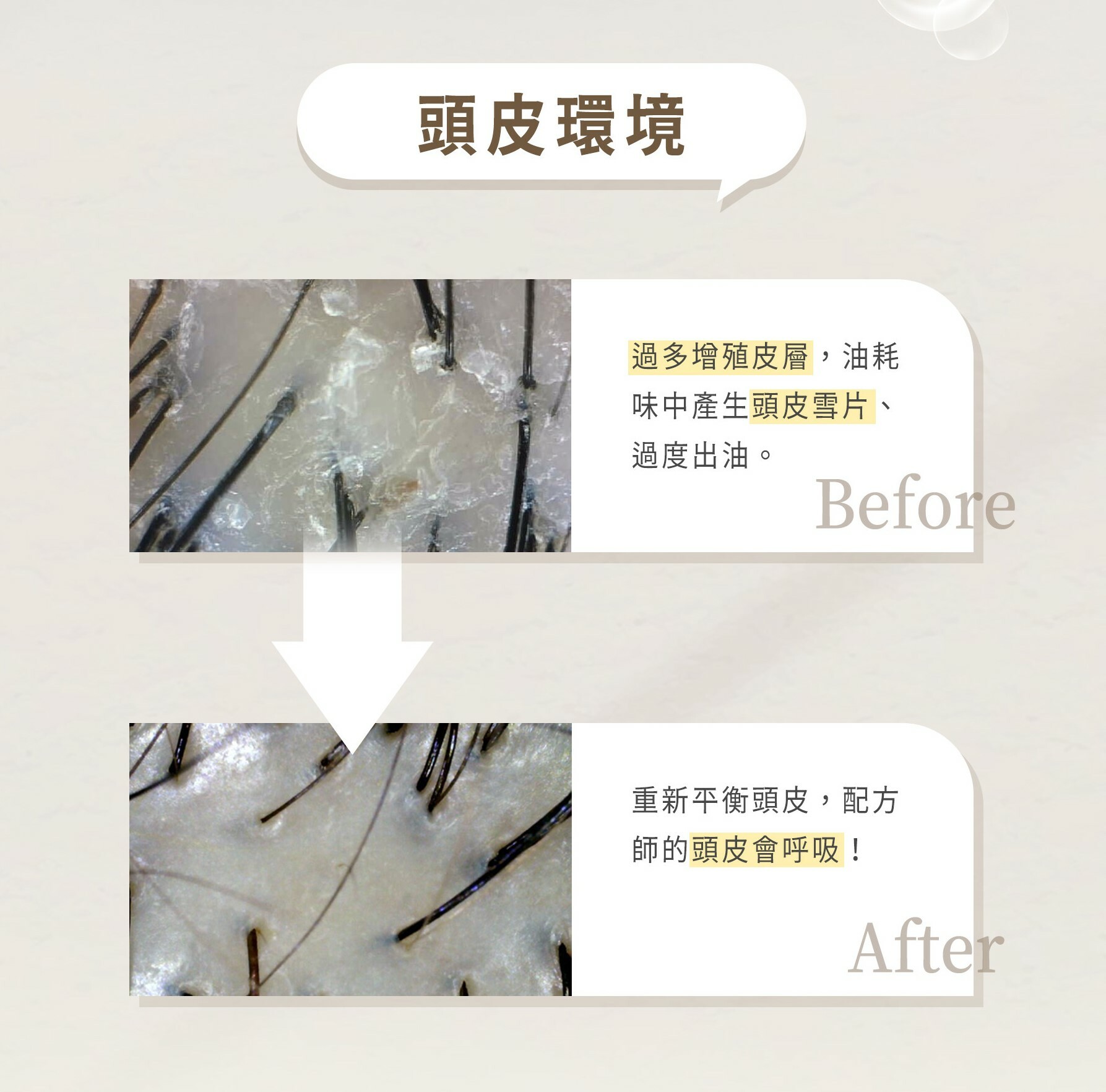 頭皮環境