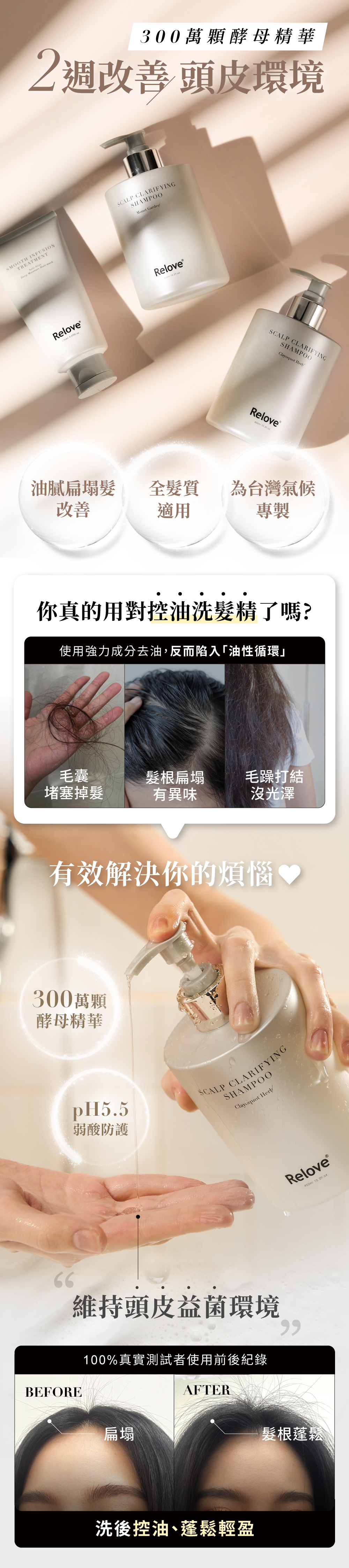 107酵萃™蓬鬆控油淨化頭皮洗髮精300萬顆酵母精華