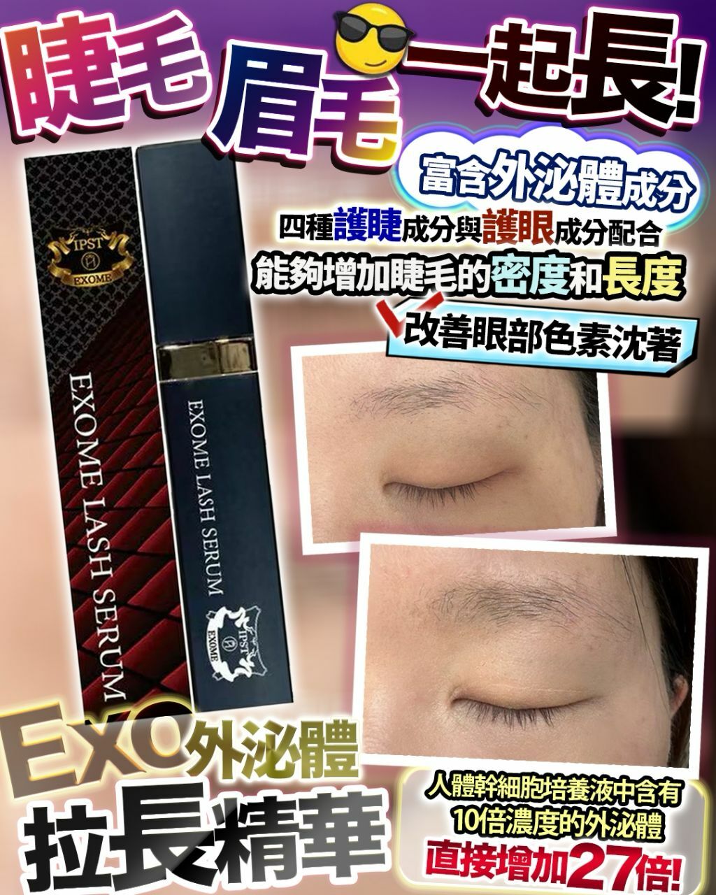 拉長精華 R579（2-3星期寄出）