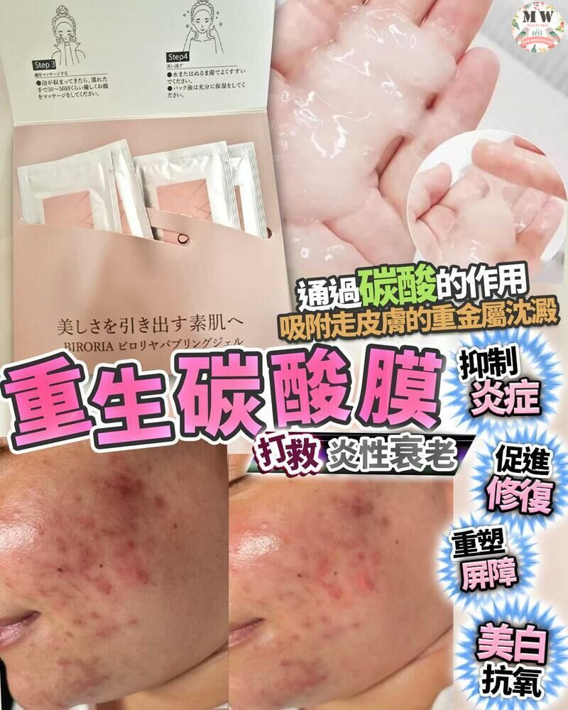 日本 BIRORIA 重生碳酸面膜 (1盒4次)