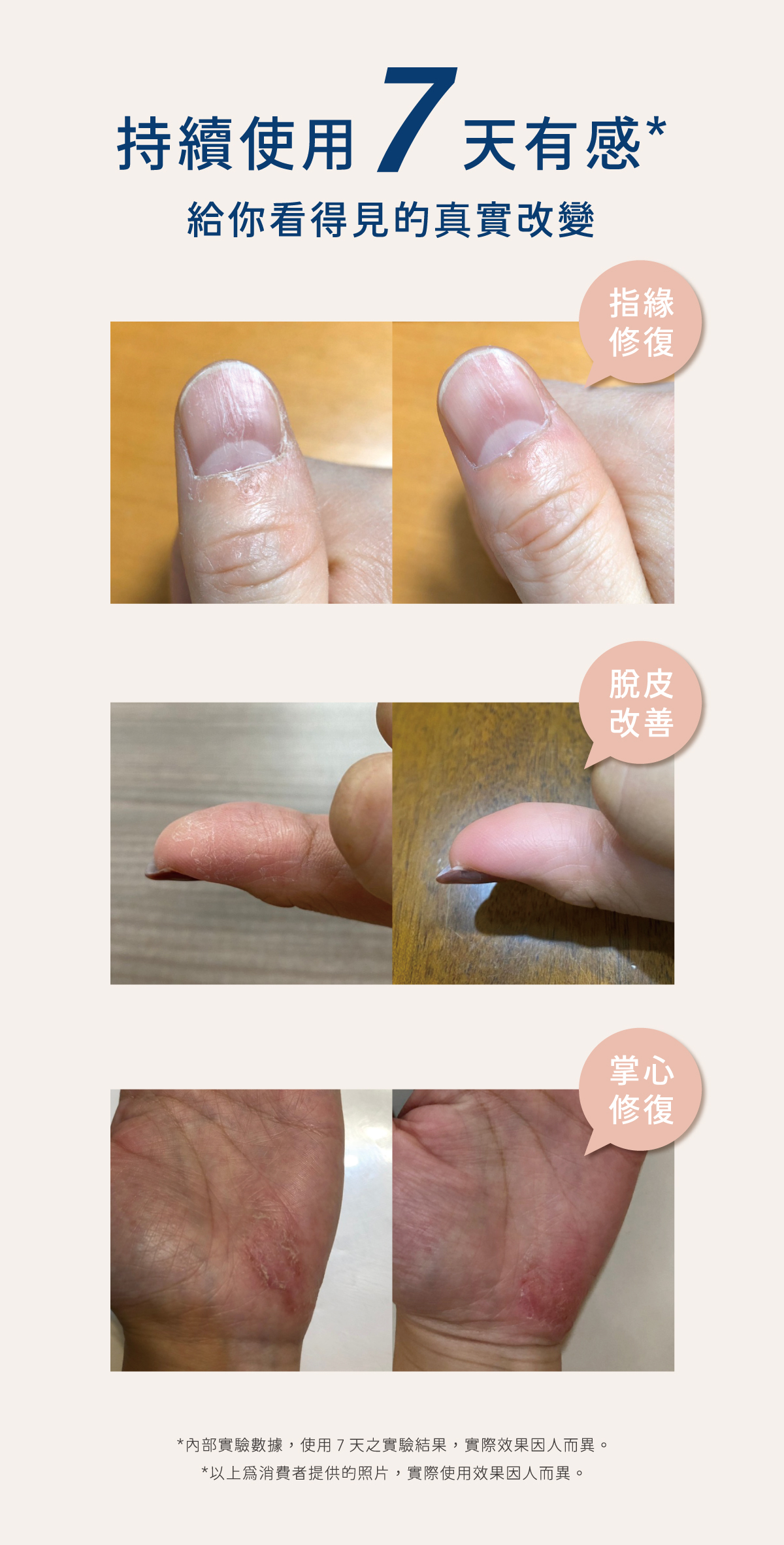 使用7天有感，極境修復美手霜有效修復指緣脫皮與掌心乾裂