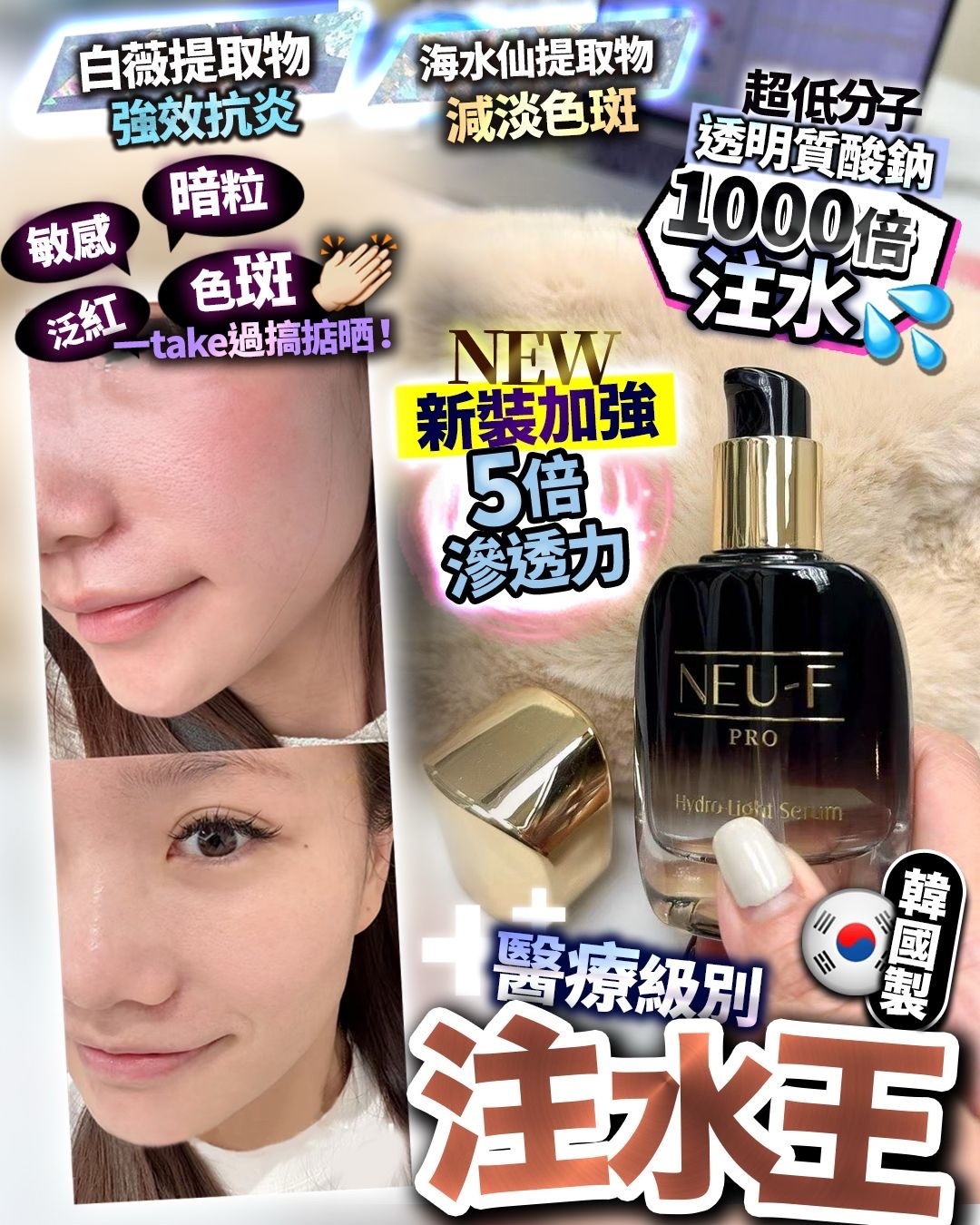 新版‼️NEU-F 注水王 30ml