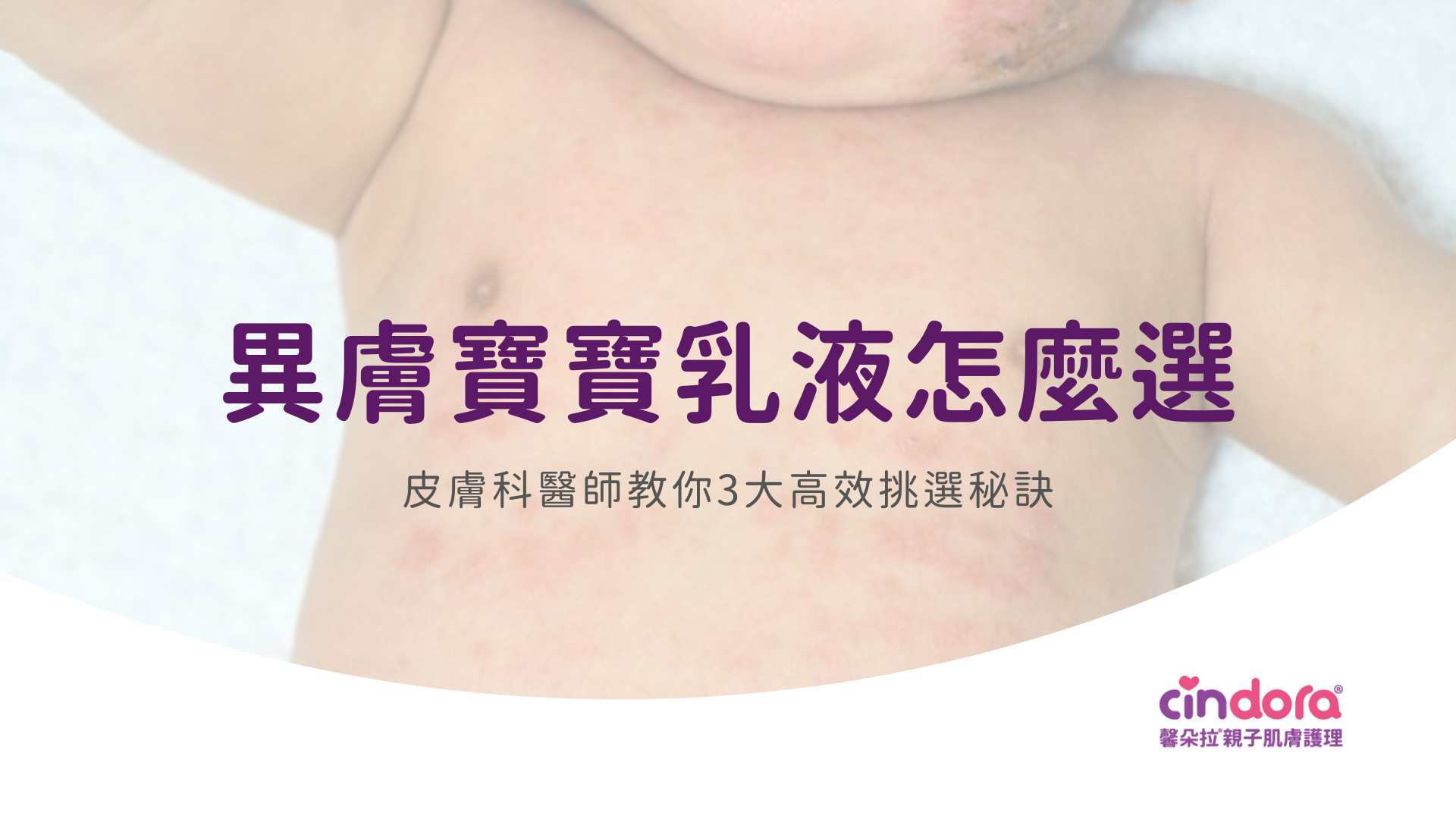 異膚寶寶乳液怎麼選？