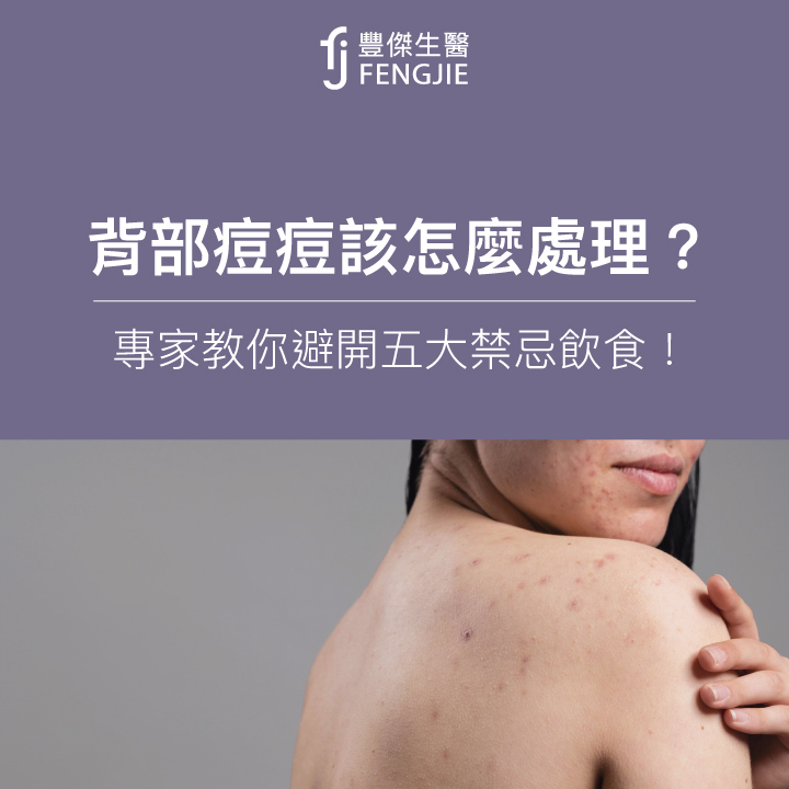 背部痘痘該怎麼處理? 專家教你避開五大禁忌飲食！