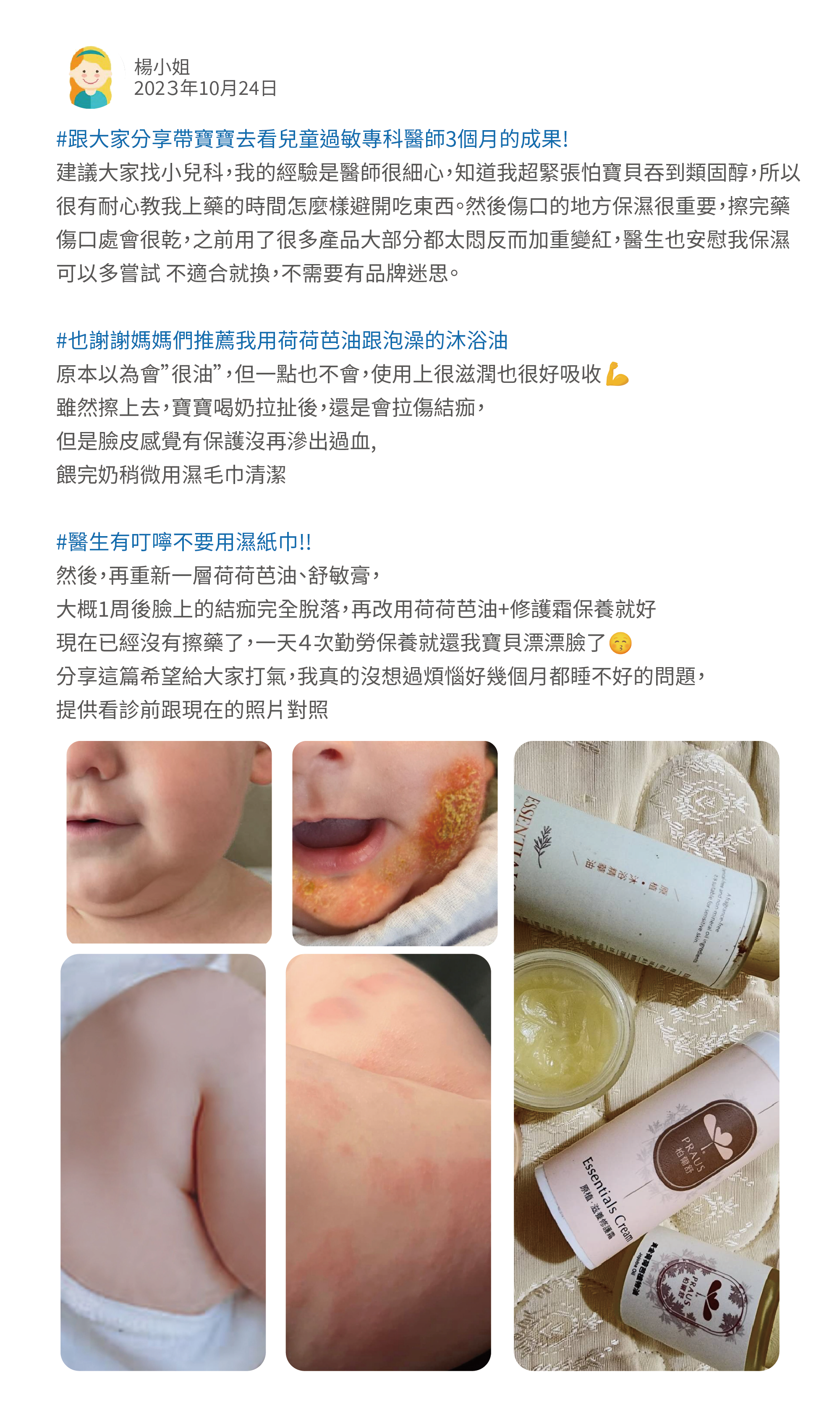 分享帶寶寶去看過的成果! 建議大家找小兒科,我的經驗是醫師很細心,我超緊張怕寶貝吞到類固醇