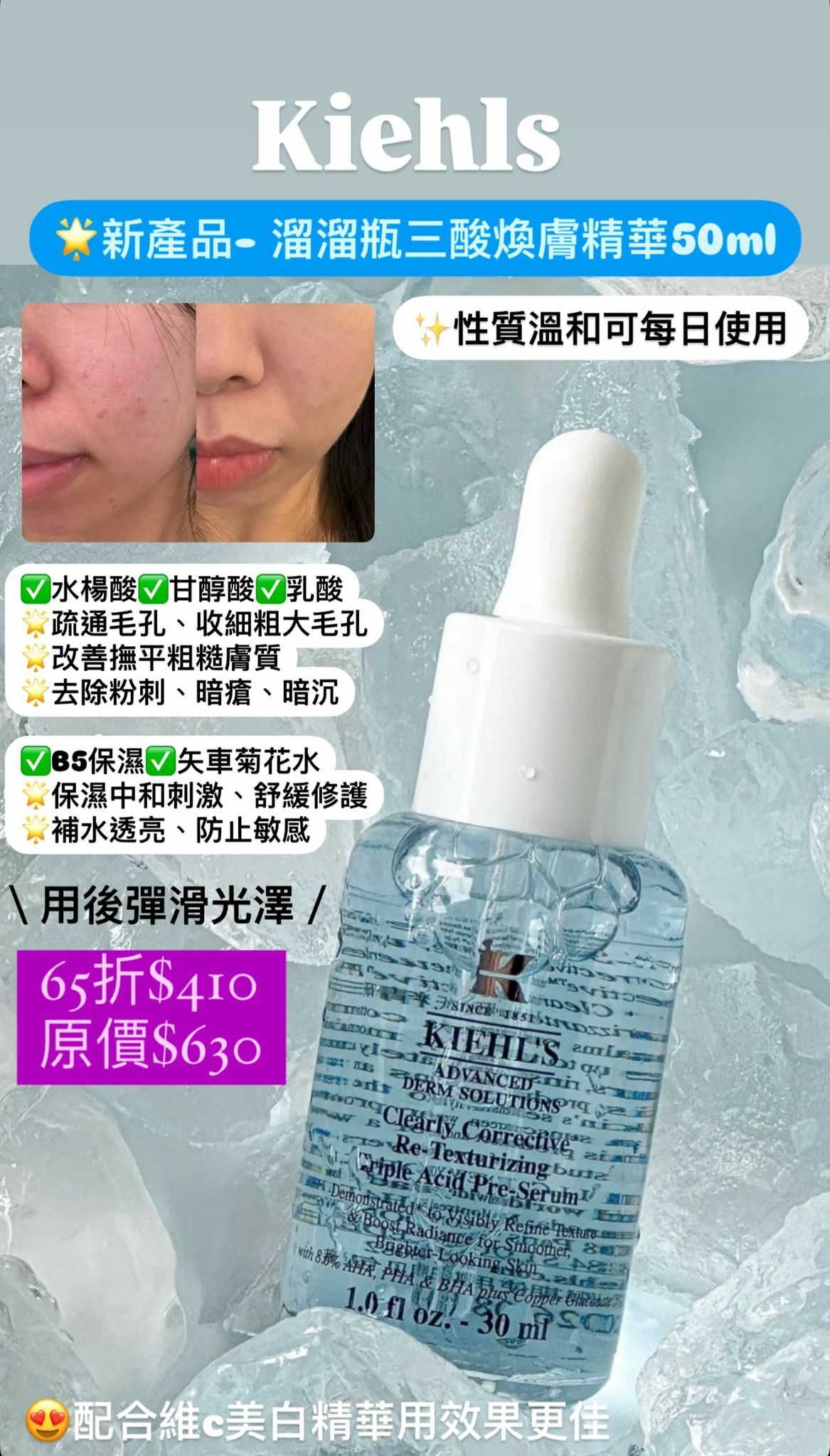 Kiehls 溜溜瓶三酸煥膚精華