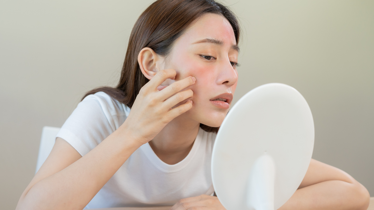 皮膚每到換季就開始乾癢、泛紅、爆痘