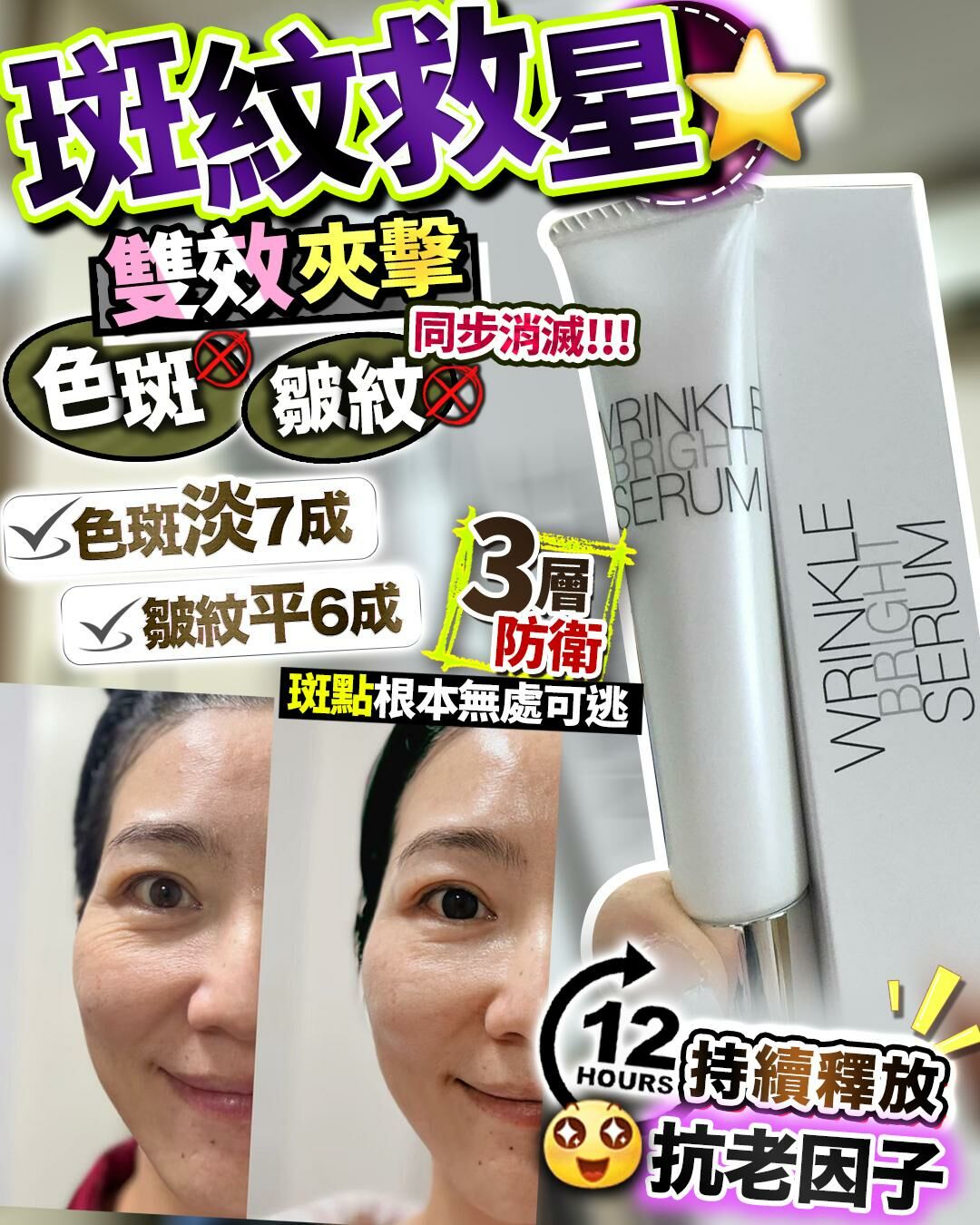 斑紋救星 20g  R670（3 星期寄出）