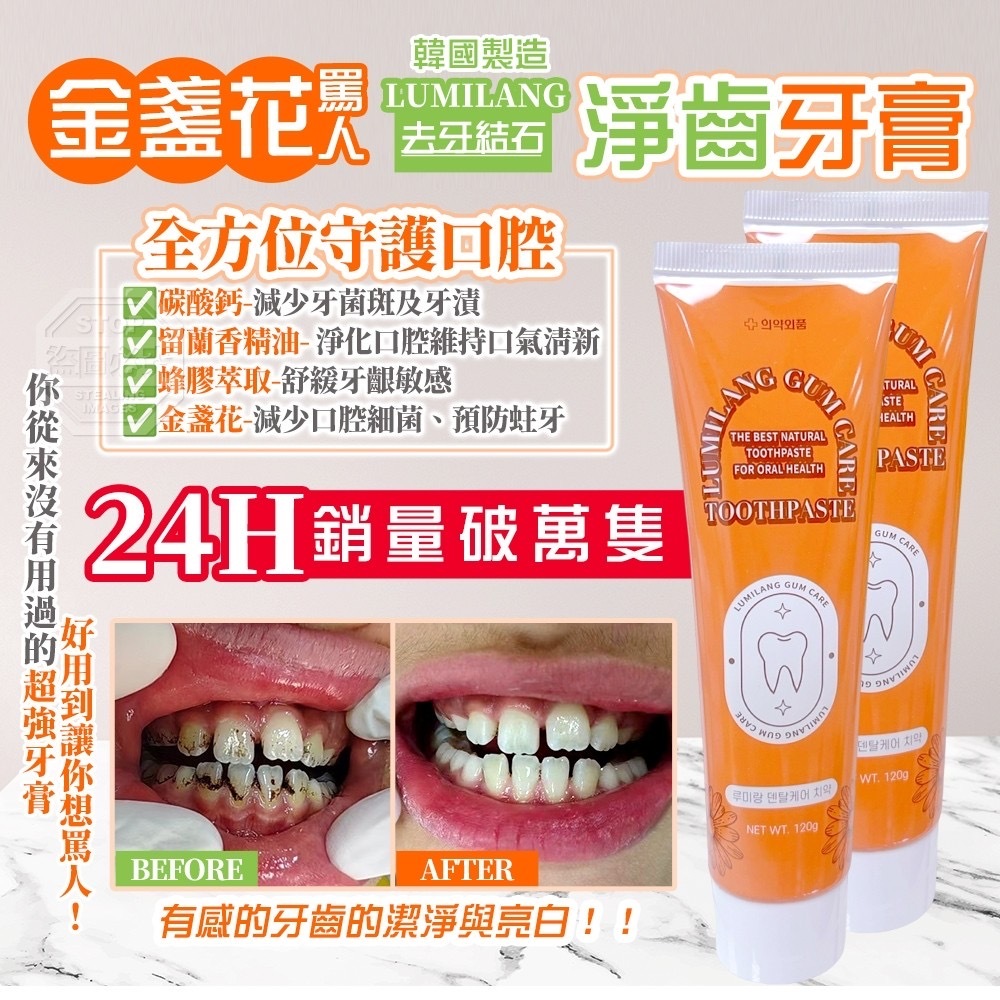 韓國製造LUMILANG金盞花罵人去牙結石淨齒牙膏120g 1套2條