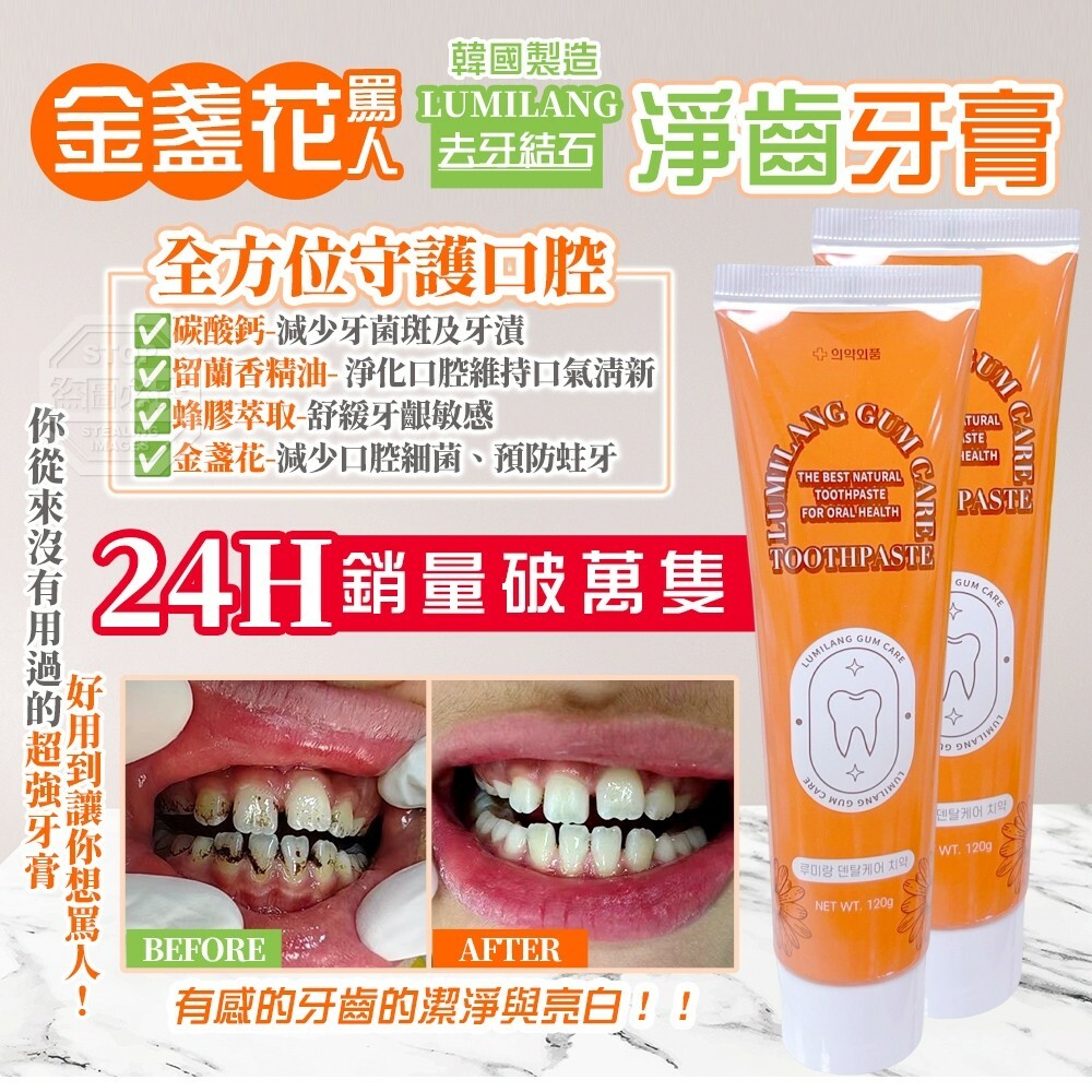 韓國製造LUMILANG 金盞花罵人去牙結石淨齒牙膏 《一套兩條》